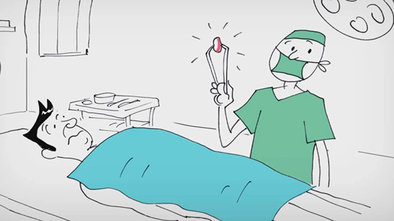 אנימציה רפואית